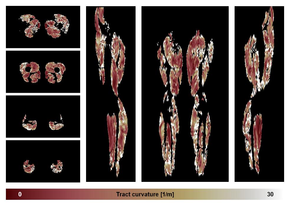 Muscle fiber tract curvature map based on whole leg DTI based fiber tractography.