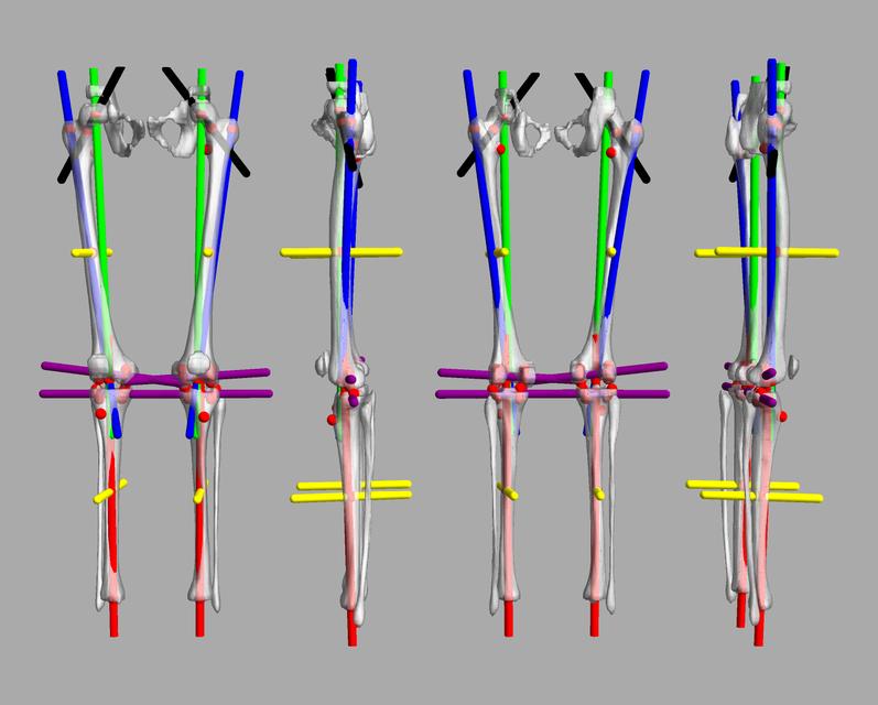 3D render of automated bone segmentation and force lines.