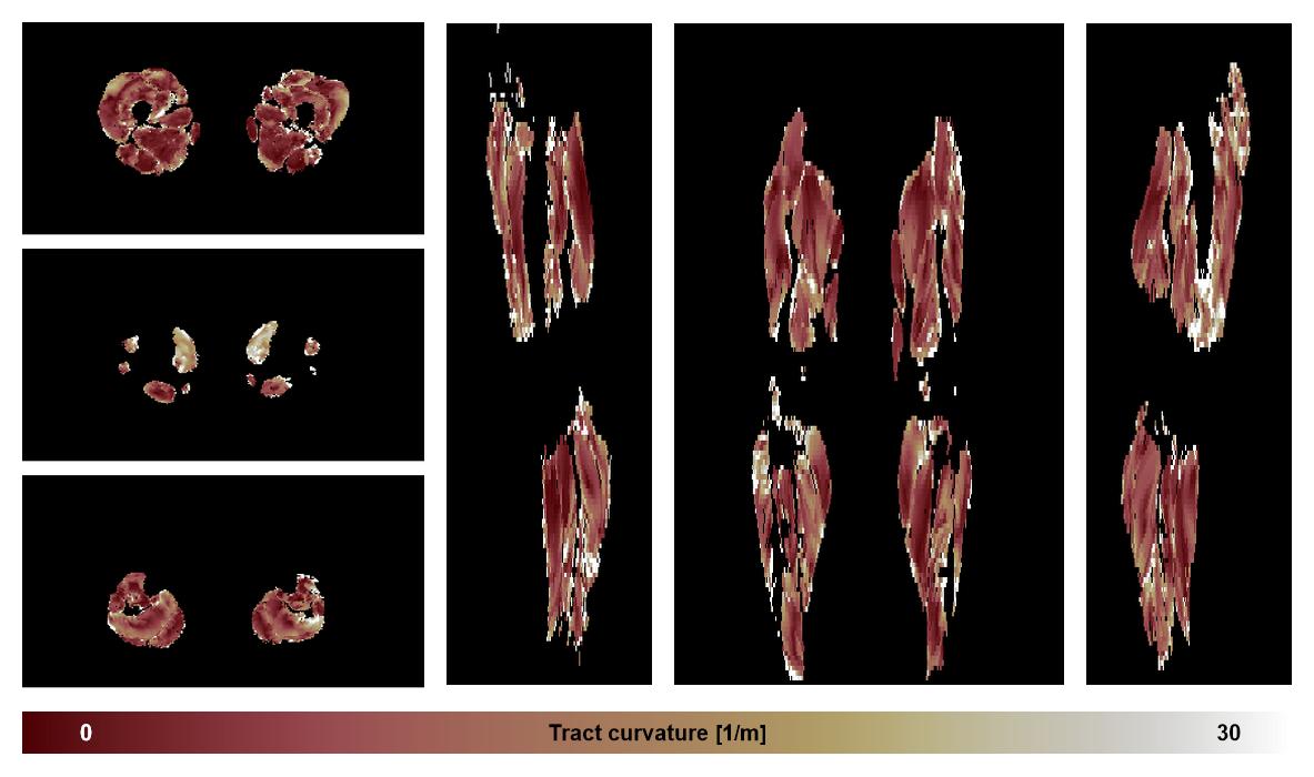 Muscle fiber tract curvature map based on whole leg DTI based fiber tractography.