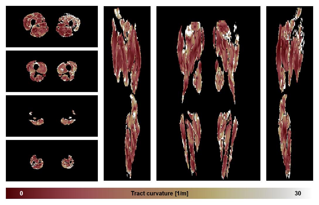 Muscle fiber tract curvature map based on whole leg DTI based fiber tractography.