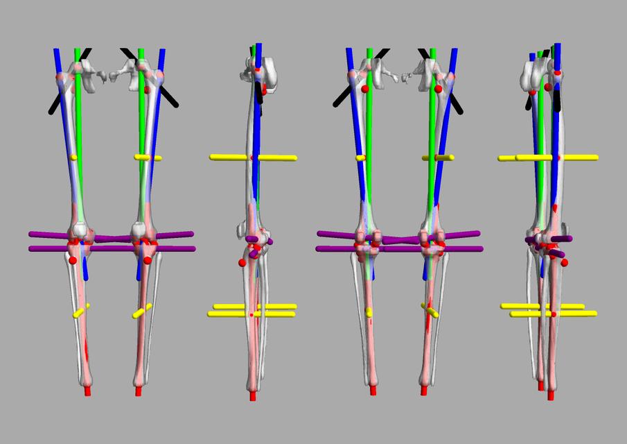 3D render of automated bone segmentation and force lines.