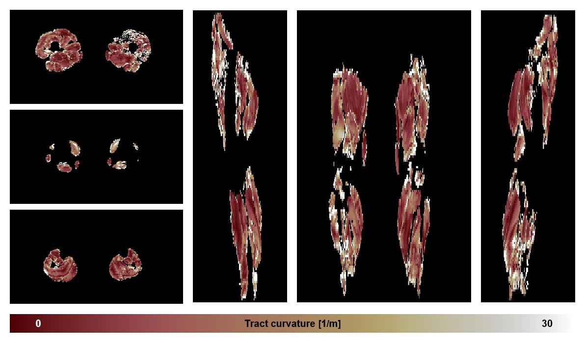 Muscle fiber tract curvature map based on whole leg DTI based fiber tractography.