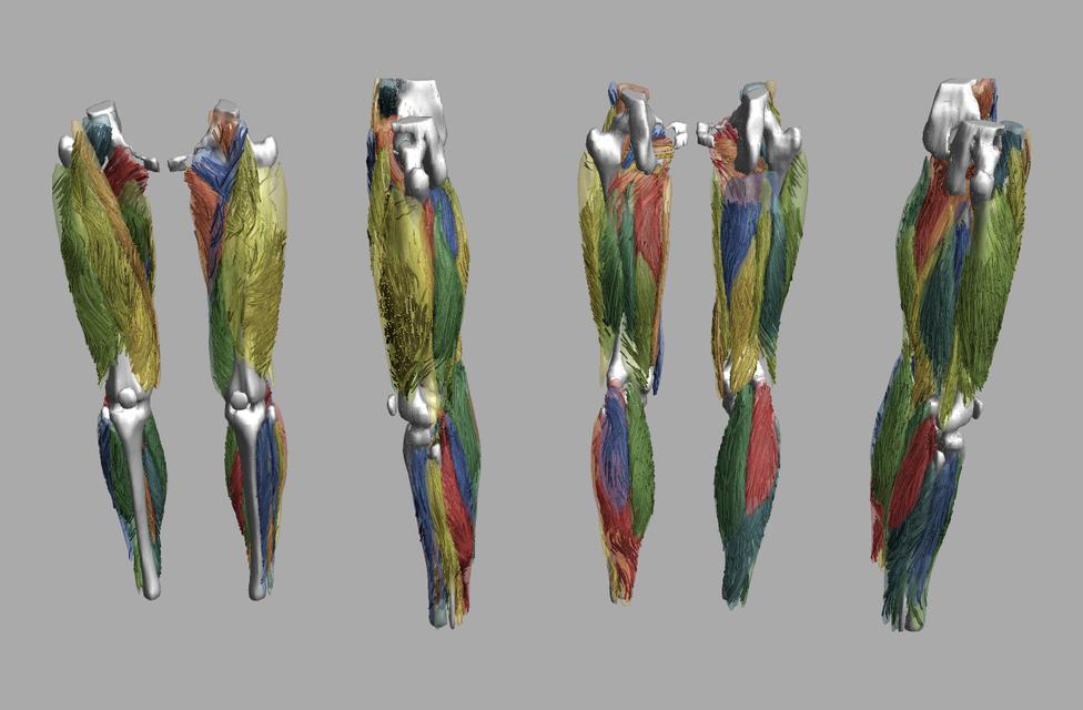 Whole leg 3D fiber tractography of all muscles segmented using a CNN UNET.