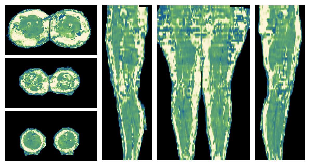 The water only T2 relaxation time of the lower extremity obtained from multi echo spin echo t2 mapping with EPG based reconstruction.