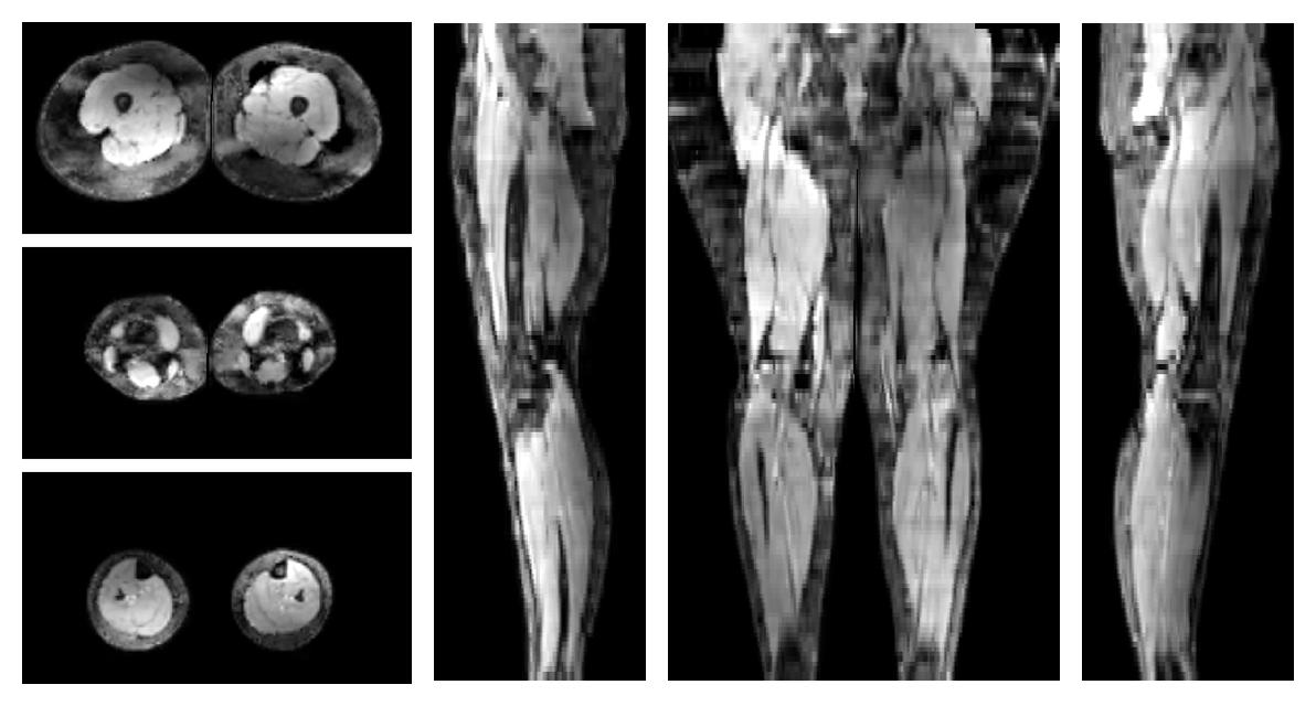 The water part of the acquired multi-echo spin echo data.