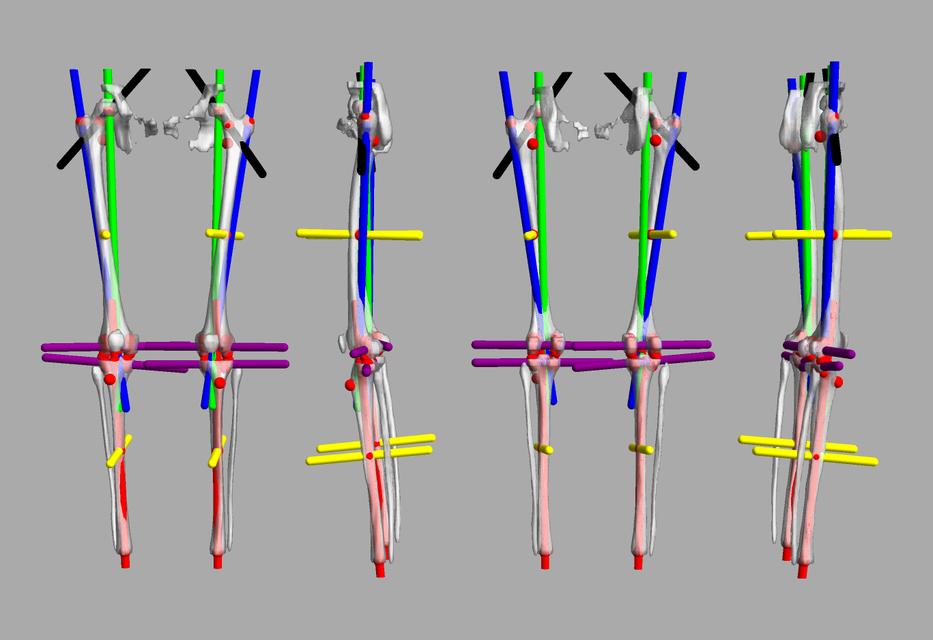 3D render of automated bone segmentation and force lines.