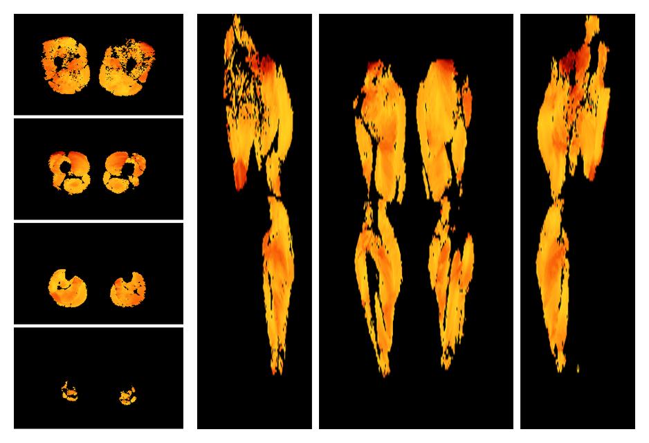 Muscle fiber tract angle map based on whole leg DTI based fiber tractography.