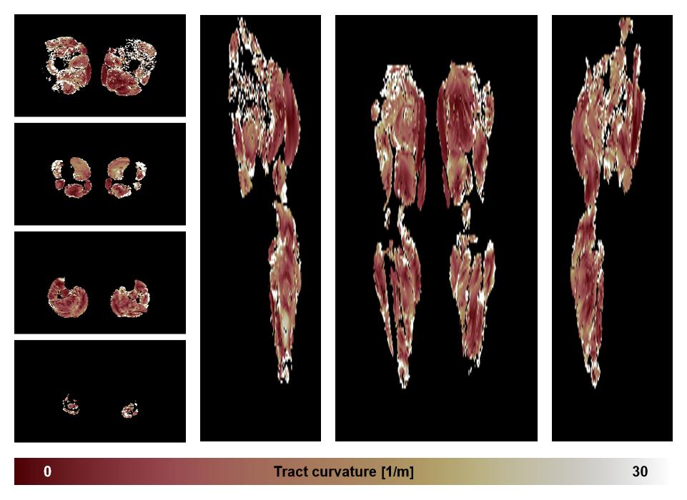 Muscle fiber tract curvature map based on whole leg DTI based fiber tractography.