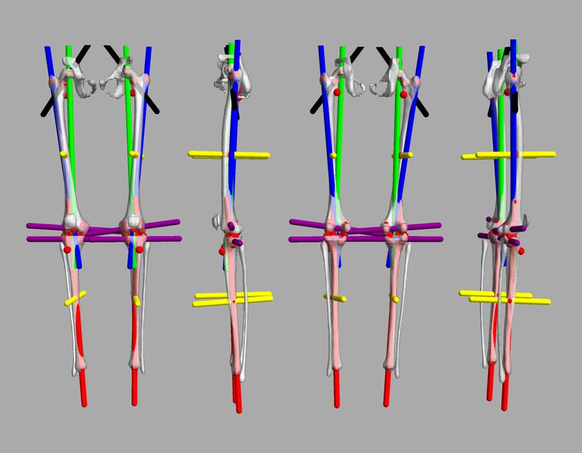 3D render of automated bone segmentation and force lines.