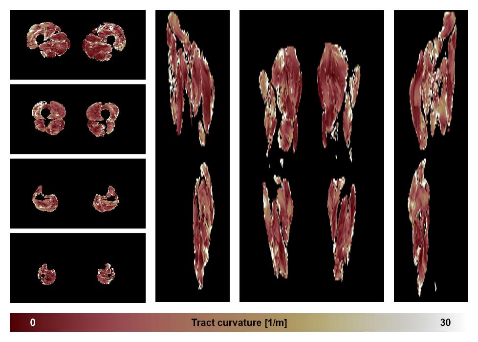 Muscle fiber tract curvature map based on whole leg DTI based fiber tractography.