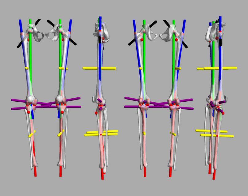 3D render of automated bone segmentation and force lines.