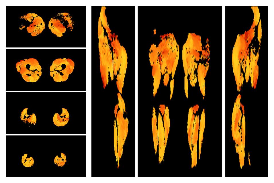 Muscle fiber tract angle map based on whole leg DTI based fiber tractography.