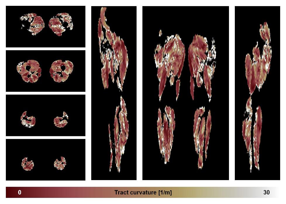 Muscle fiber tract curvature map based on whole leg DTI based fiber tractography.