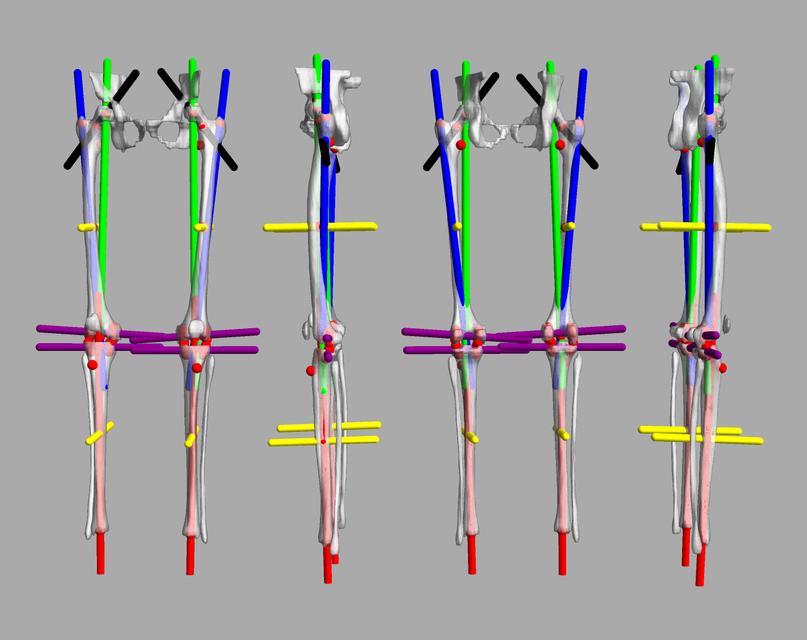 3D render of automated bone segmentation and force lines.