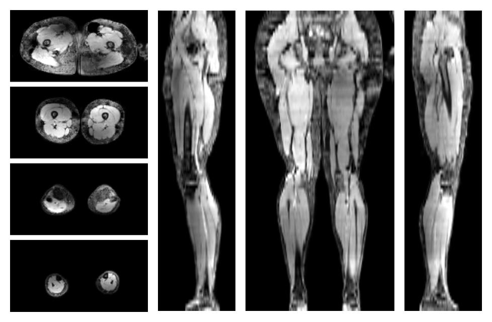 The water part of the acquired multi-echo spin echo data.