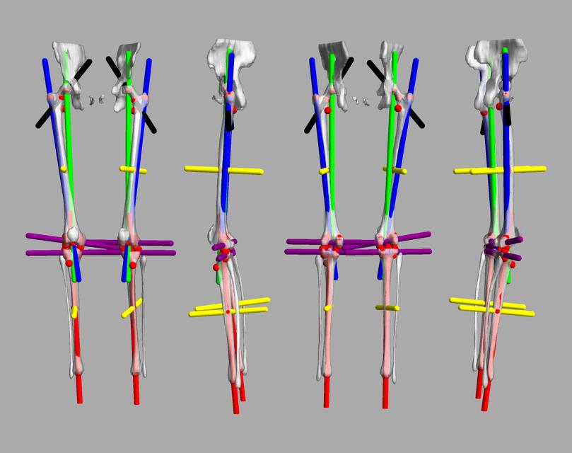 3D render of automated bone segmentation and force lines.