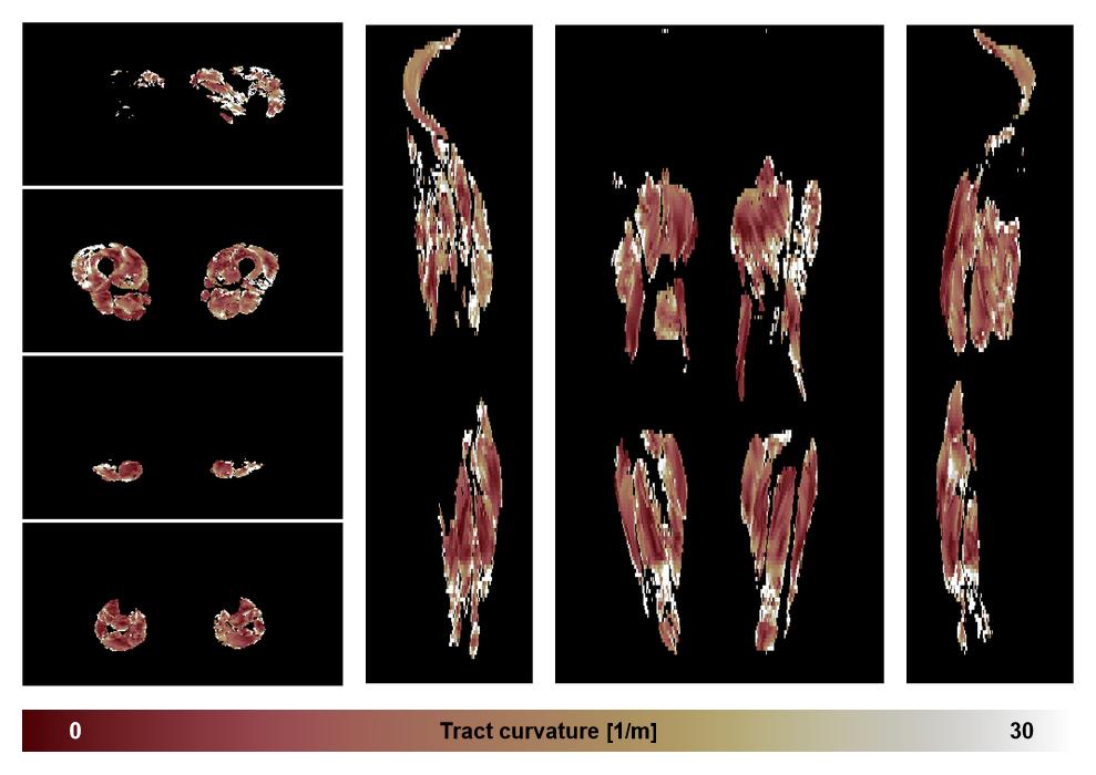 Muscle fiber tract curvature map based on whole leg DTI based fiber tractography.