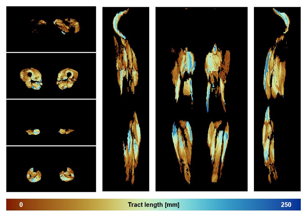 Muscle fiber tract length map based on whole leg DTI based fiber tractography.