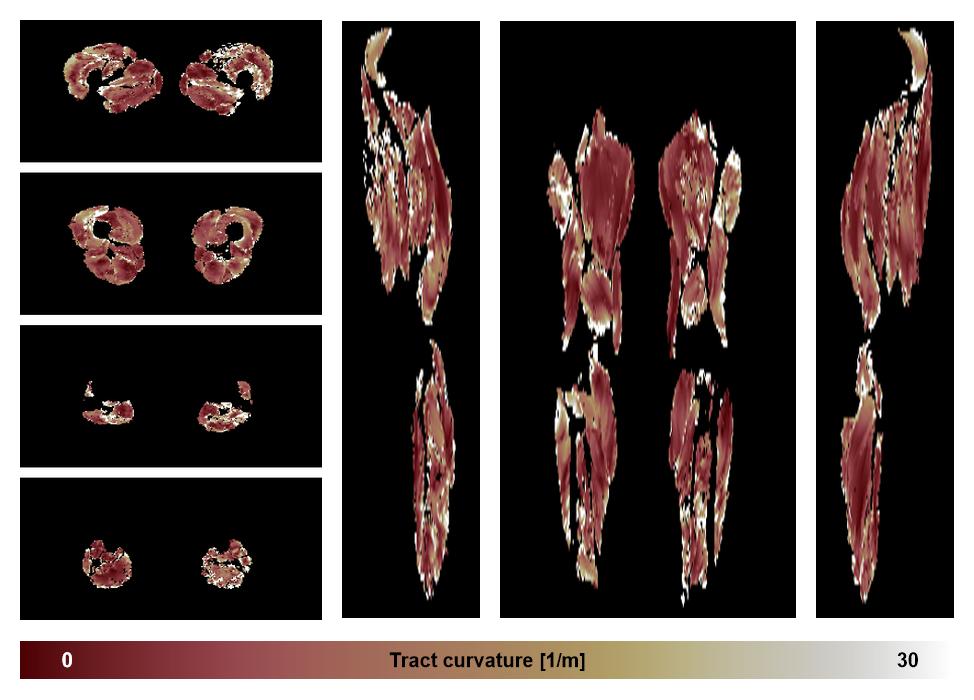 Muscle fiber tract curvature map based on whole leg DTI based fiber tractography.