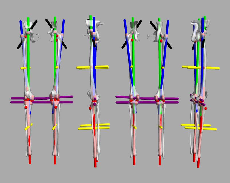 3D render of automated bone segmentation and force lines.