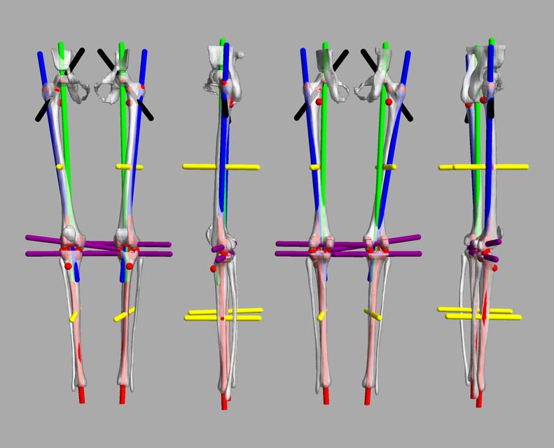 3D render of automated bone segmentation and force lines.