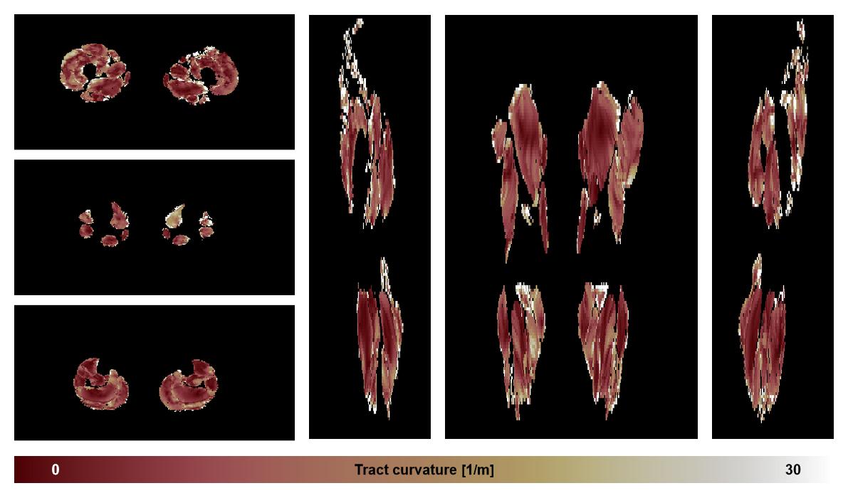 Muscle fiber tract curvature map based on whole leg DTI based fiber tractography.