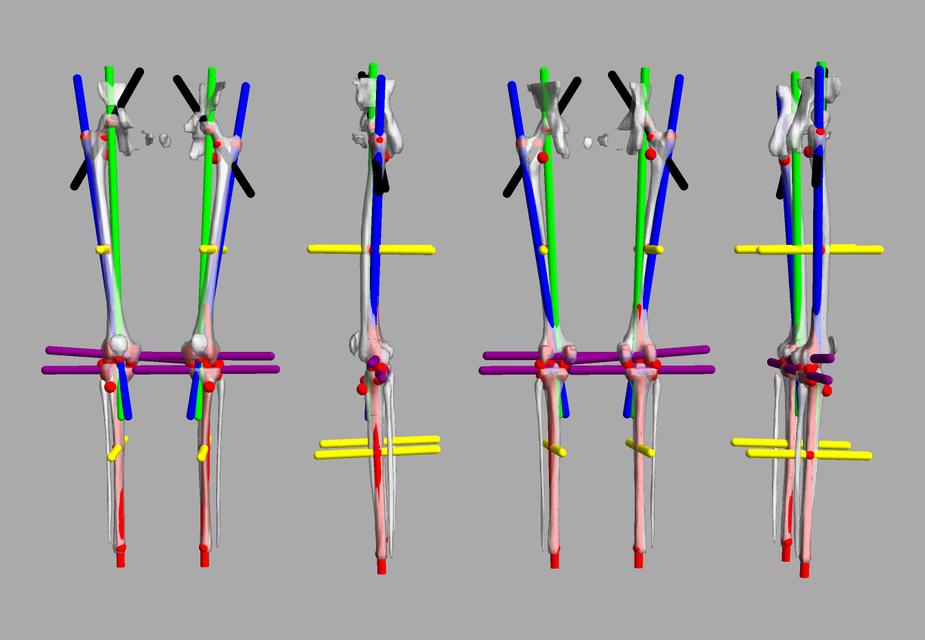 3D render of automated bone segmentation and force lines.