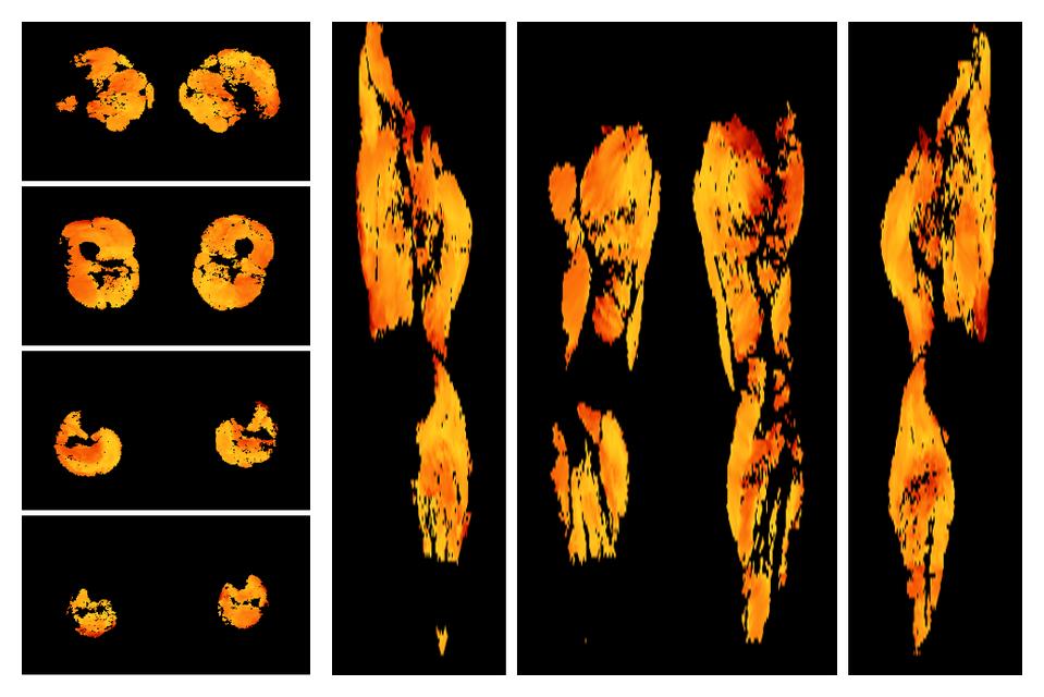 Muscle fiber tract angle map based on whole leg DTI based fiber tractography.