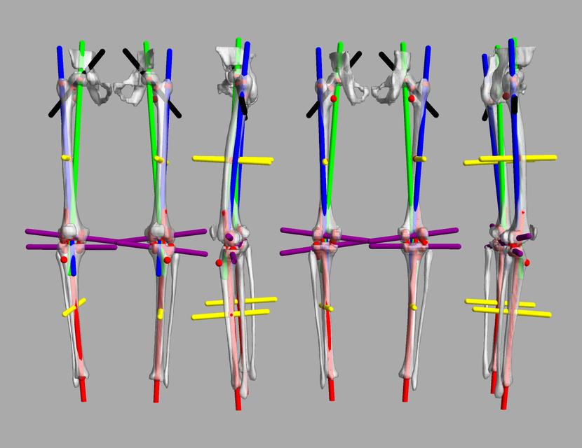 3D render of automated bone segmentation and force lines.