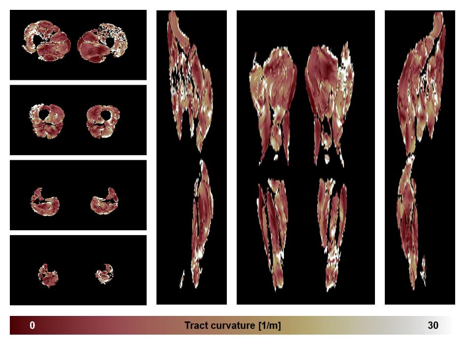 Muscle fiber tract curvature map based on whole leg DTI based fiber tractography.