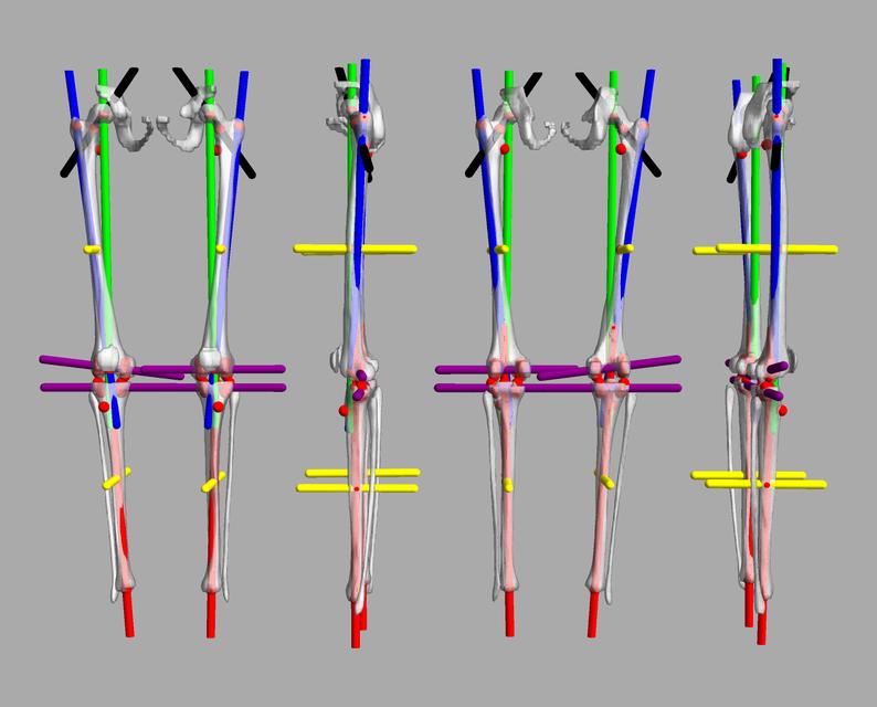 3D render of automated bone segmentation and force lines.