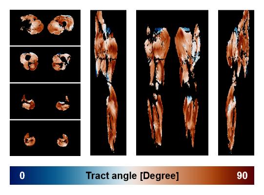 Muscle fiber tract angle map based on whole leg DTI based fiber tractography.