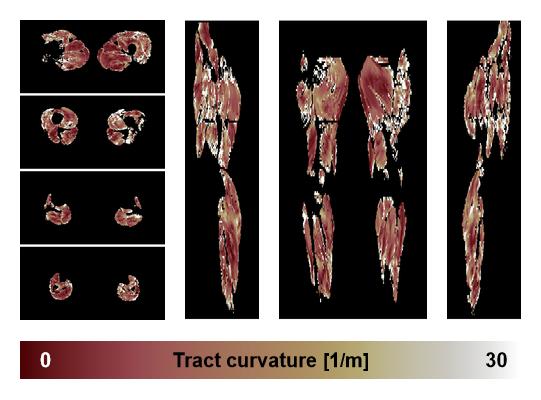 Muscle fiber tract curvature map based on whole leg DTI based fiber tractography.