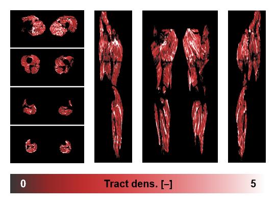 Muscle fiber tract density map based on whole leg DTI based fiber tractography.