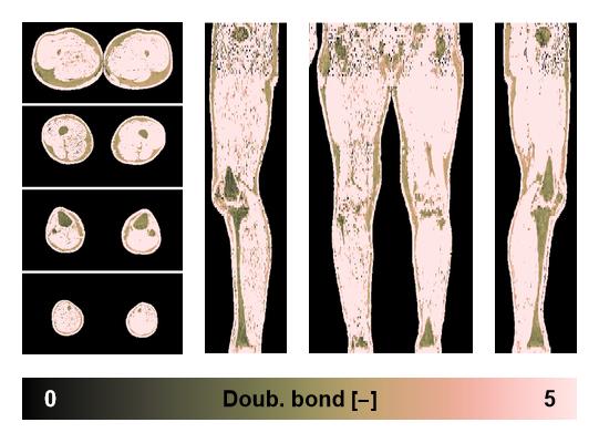 Number of double bonds in subcutanious fat.