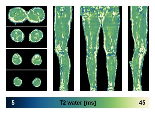 The water only T2 relaxation time of the lower extremity obtained from multi echo spin echo t2 mapping with EPG based reconstruction.