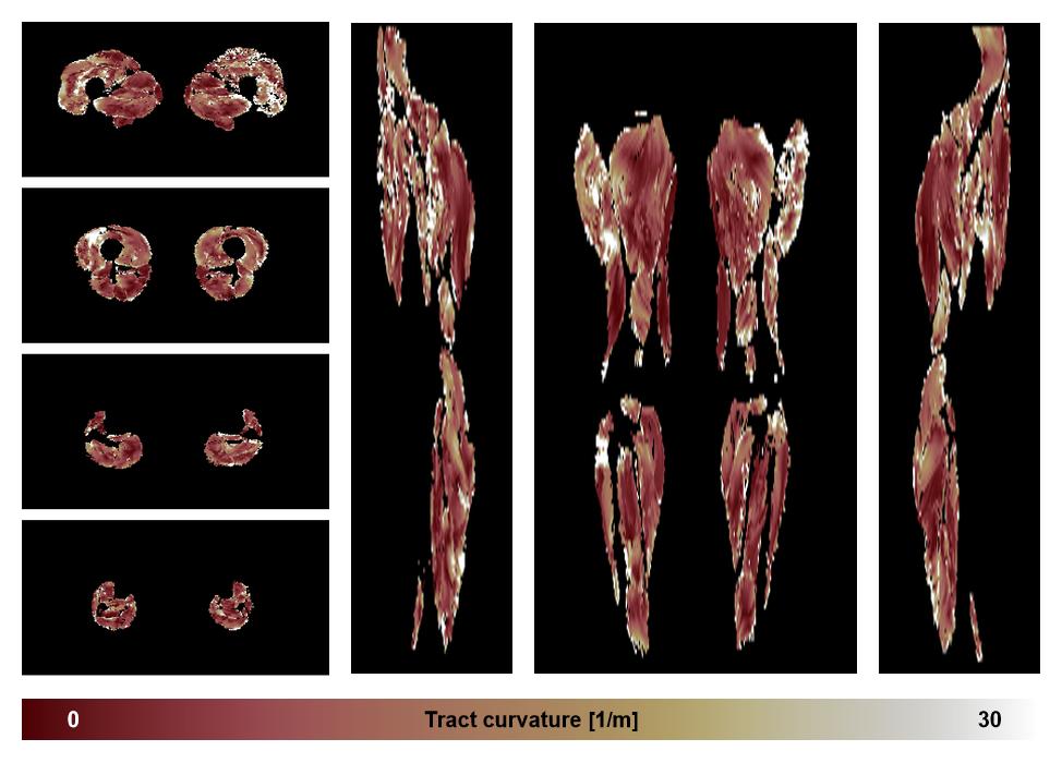 Muscle fiber tract curvature map based on whole leg DTI based fiber tractography.