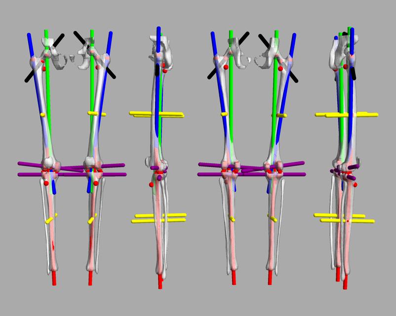 3D render of automated bone segmentation and force lines.