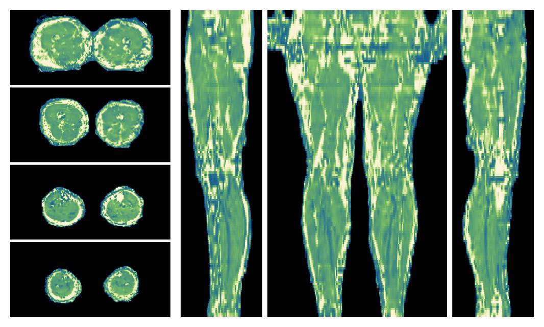 The water only T2 relaxation time of the lower extremity obtained from multi echo spin echo t2 mapping with EPG based reconstruction.