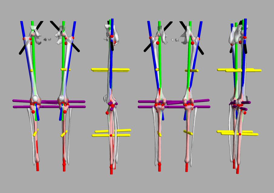 3D render of automated bone segmentation and force lines.