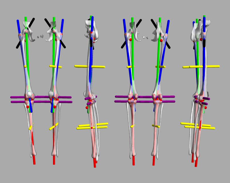 3D render of automated bone segmentation and force lines.