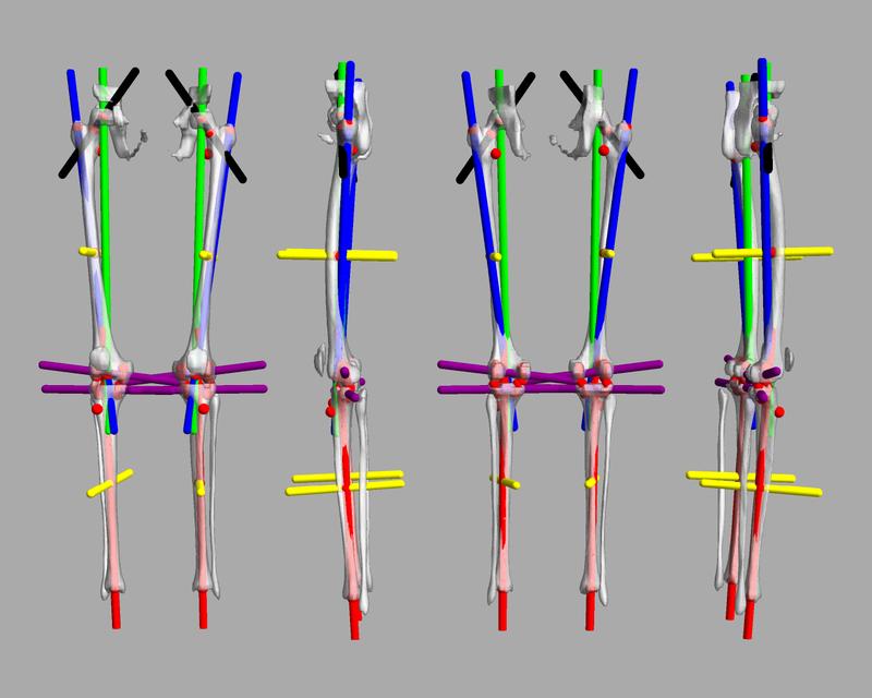 3D render of automated bone segmentation and force lines.