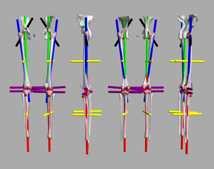 3D render of automated bone segmentation and force lines.