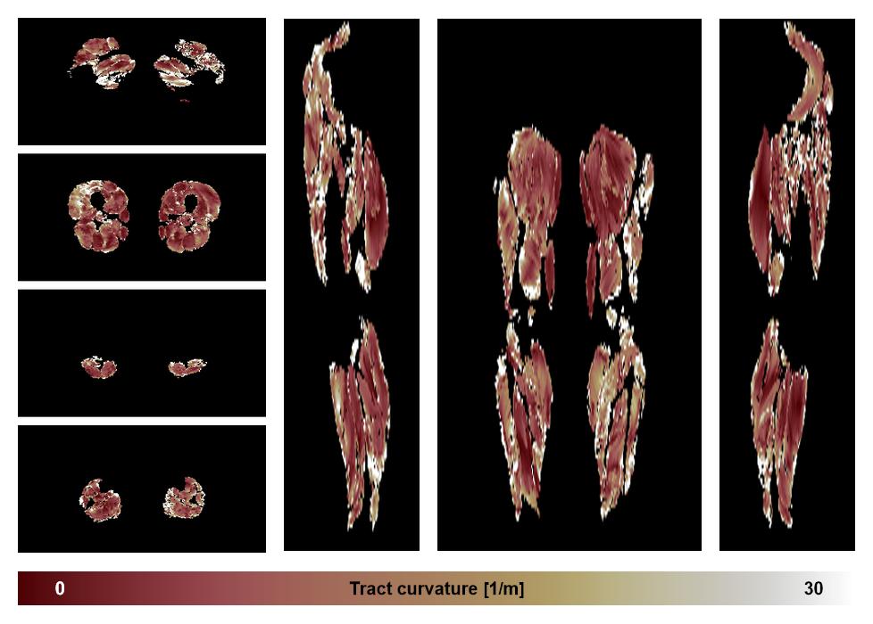 Muscle fiber tract curvature map based on whole leg DTI based fiber tractography.