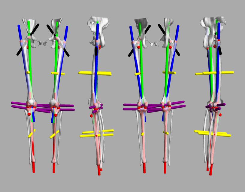 3D render of automated bone segmentation and force lines.