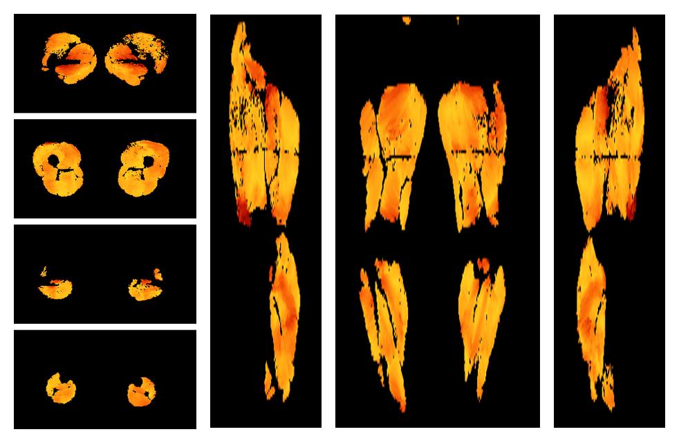 Muscle fiber tract angle map based on whole leg DTI based fiber tractography.