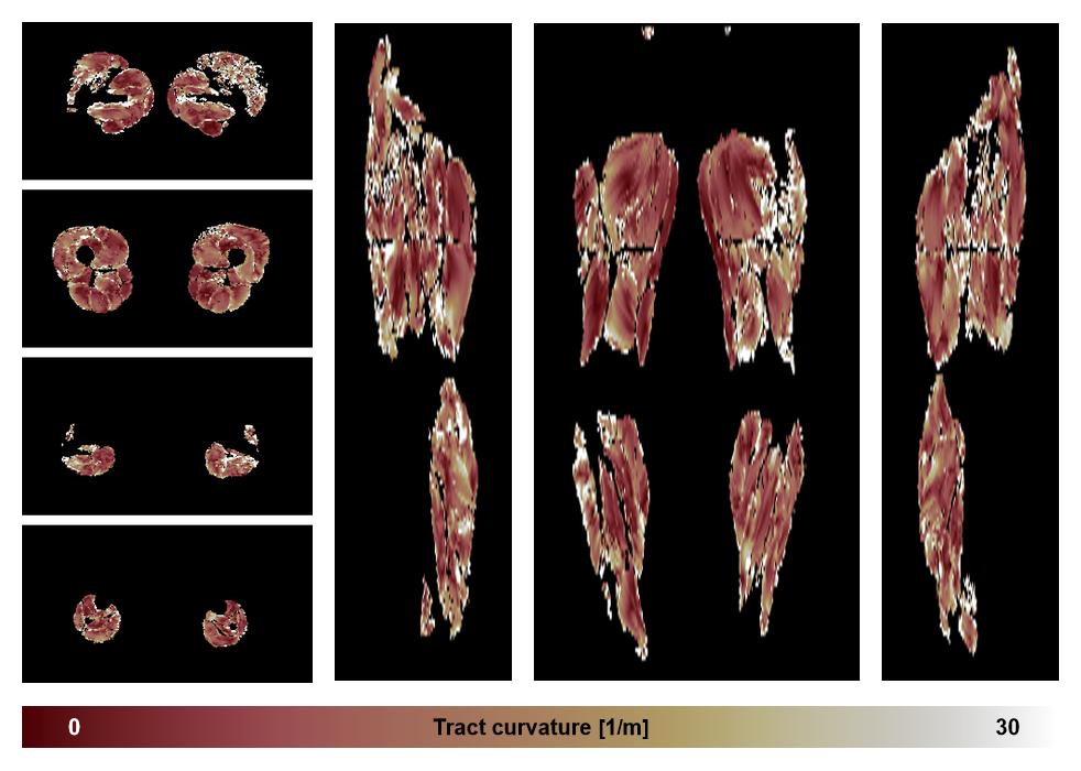 Muscle fiber tract curvature map based on whole leg DTI based fiber tractography.